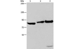Western Blot analysis of NIH/3T3 cell, Mouse lung and liver tissue using MAPRE3 Polyclonal Antibody at dilution of 1:550 (ECE1 抗体)