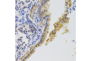 Immunohistochemistry of paraffin-embedded mouse lung using KIF1B Antibody (ABIN2563552) at dilution of 1:100 (40x lens). (KIF1B 抗体)