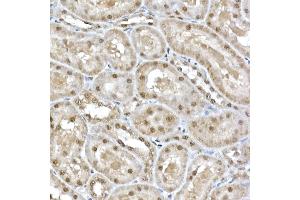 Immunohistochemistry (IHC) image for anti-Small Nuclear Ribonucleoprotein D1 Polypeptide 16kDa (SNRPD1) (AA 1-100) antibody (ABIN7270363)