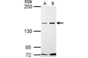 WB Image GLI3 antibody detects GLI3 protein by Western blot analysis. (GLI3 抗体)