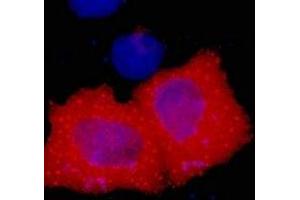 Immunofluorescent analysis of HA-tag staining in 293T cells transfected with a HA-tag protein. (HA-Tag 抗体)