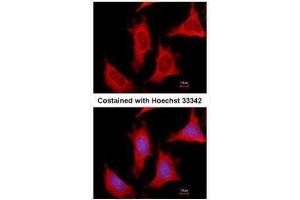 ICC/IF Image Immunofluorescence analysis of methanol-fixed HeLa, using PPAT, antibody at 1:500 dilution. (PPAT 抗体)