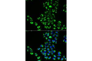 Immunofluorescence analysis of A549 cells using EIF5B antibody (ABIN6291145). (EIF5B 抗体)