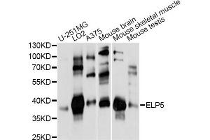 Western blot analysis of extracts of various cell lines, using ELP5 antibody (ABIN6292001) at 1:1000 dilution. (Retinoic Acid Induced 12 (RAI12) 抗体)