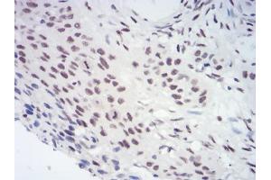 Immunohistochemistry (IHC) image for anti-Chromobox Homolog 3 (CBX3) (AA 1-183) antibody (ABIN5889677) (CBX3 抗体  (AA 1-183))