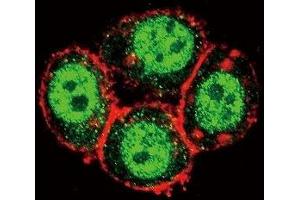 Confocal immunofluorescent analysis of PAK1 antibody with HeLa cells followed by Alexa Fluor 488-conjugated goat anti-rabbit lgG (green). (PAK1 抗体  (AA 401-430))