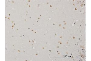 Immunostaining (ISt) image for anti-ABL2 (ABL2) (AA 743-842) antibody (ABIN513042)