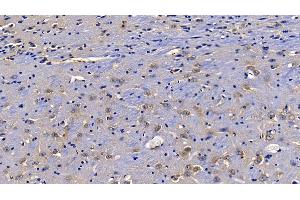 Detection of TOLLIP in Mouse Cerebrum Tissue using Polyclonal Antibody to Toll Interacting Protein (TOLLIP) (TOLLIP 抗体  (AA 19-254))