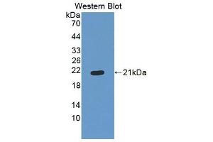 Western Blotting (WB) image for anti-Collagen, Type XVIII, alpha 1 (COL18A1) (AA 1154-1335) antibody (ABIN7445252)