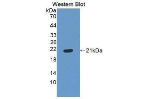 Detection of Recombinant ES, Human using Polyclonal Antibody to Endostatin (ES) (COL18A1 抗体  (AA 1154-1335))