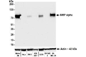 Western Blotting (WB) image for anti-Signal-Regulatory Protein alpha (SIRPA) (AA 31-368) antibody (ABIN7453985)
