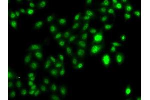 Immunofluorescence analysis of U2OS cells using CBFA2T2 antibody. (CBFA2T2 抗体  (AA 325-604))