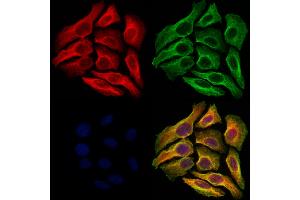ABIN6264177 and ABIN6273064 staining Hela cells by IF/ICC. (PHGDH 抗体  (N-Term))