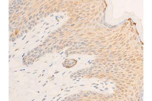 ABIN6267219 at 1/100 staining human skin tissue sections by IHC-P.
