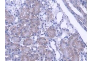 Immunohistochemistry (IHC) image for anti-Protein tyrosine Phosphatase, Non-Receptor Type 21 (PTPN21) (AA 983-1176) antibody (ABIN7444973)