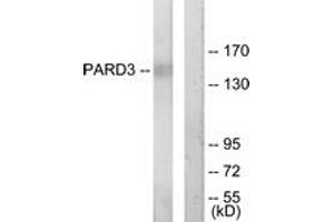 Western blot analysis of extracts from COLO205 cells, using PARD3 Antibody. (PARD3 抗体  (AA 1141-1190))