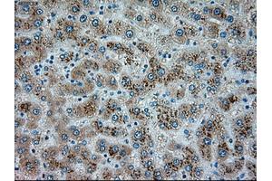 Immunohistochemical staining of paraffin-embedded pancreas tissue using anti-SERPINA1mouse monoclonal antibody. (SERPINA1 抗体)