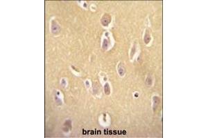 Immunohistochemistry (Paraffin-embedded Sections) (IHC (p)) image for anti-Olfactory Receptor, Family 13, Subfamily J, Member 1 (OR13J1) (AA 244-272), (C-Term) antibody (ABIN655013)
