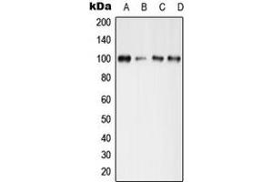Western blot analysis of GLUR4 (pS862) expression in MCF7 Forskonlin-treated (A), mouse brain (B), mouse spleen (C), rat spleen (D) whole cell lysates. (GRIA4 抗体  (C-Term, pSer862))