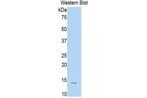 Western Blotting (WB) image for Slit Homolog 1 (SLIT1) ELISA Kit (ABIN6574316)