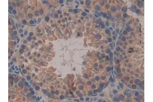 Detection of CNX in Mouse Testis Tissue using Polyclonal Antibody to Calnexin (CNX) (Calnexin 抗体  (AA 263-482))