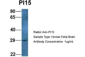 Host: Rabbit Target Name: PI15 Sample Type: Human Fetal Brain Antibody Dilution: 1. (PI15 抗体  (N-Term))