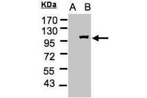 WB Image Western Blot analysis of IPO13 expression in transfected 293T cell line by IPO13 polyclonal antibody.
