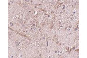 Immunohistochemistry of TOM70 in mouse brain tissue with this product at 2. (TOM70 抗体  (N-Term))