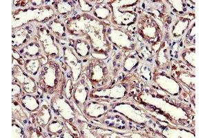 Immunohistochemistry (IHC) image for anti-Glutathione S-Transferase alpha 1 (GSTA1) (AA 2-222) antibody (ABIN7154085)