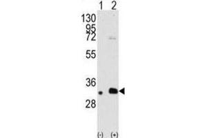 Western Blotting (WB) image for anti-Melanoma Antigen Family B, 2 (MAGEB2) antibody (ABIN3002533) (MAGEB2 抗体)