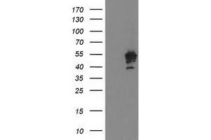 Western Blotting (WB) image for anti-Protein tyrosine Phosphatase, Non-Receptor Type 7 (PTPN7) antibody (ABIN1500502) (PTPN7 抗体)