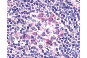 Anti-FLT3 / CD135 antibody IHC of human tonsil. (FLT3 抗体)