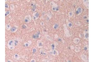 Immunohistochemistry (IHC) image for anti-Cytochrome P450, Family 1, Subfamily A, Polypeptide 2 (CYP1A2) (AA 2-231) antibody (ABIN1176083)
