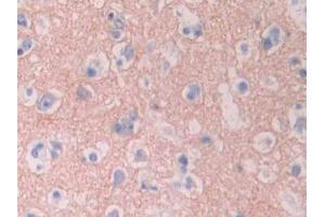 DAB staining on IHC-P;;Samples: Human Cerebrum Tissue (CYP1A2 抗体  (AA 2-231))