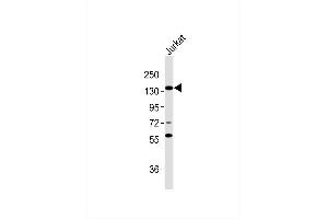 Anti-RB2 Antibody at 1:1000 dilution + Jurkat whole cell lysates Lysates/proteins at 20 μg per lane. (p130 抗体)