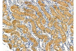 ABIN6264548 and ABIN6272405 at 1/100 staining Rat kidney tissue by IHC-P. (RAB11B 抗体  (C-Term))