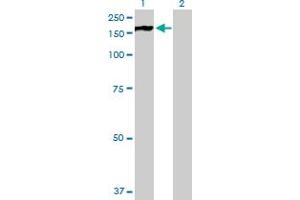 Western Blot analysis of PHKA2 expression in transfected 293T cell line by PHKA2 MaxPab polyclonal antibody. (PHKA2 抗体  (AA 1-1235))