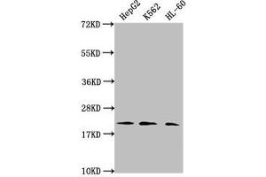 Western Blot Positive WB detected in: HepG2 whole cell lysate, K562 whole cell lysate, HL60 whole cell lysate All lanes: HIST1H1C antibody at 1:2000 Secondary Goat polyclonal to rabbit IgG at 1/40000 dilution Predicted band size: 22 kDa Observed band size: 22 kDa (HIST1H1C 抗体  (2meLys45))