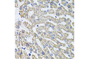 Immunohistochemistry of paraffin-embedded human liver damage using SDC2 antibody (ABIN3022587, ABIN3022588, ABIN3022589 and ABIN6218928) at dilution of 1:100 (40x lens). (Syndecan 2 抗体  (AA 19-144))