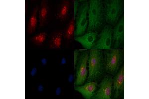 ABIN6261079 and ABIN6276536 staining  cells by IF/ICC. (CTCF 抗体  (C-Term))