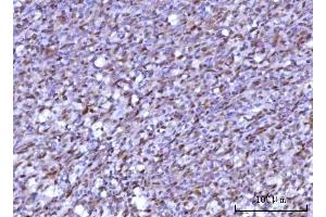 IHC analysis of RNF34 using anti-RNF34 antibody (ABIN7602457).