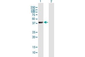 Western Blot analysis of ZNF385B expression in transfected 293T cell line by ZNF385B MaxPab polyclonal antibody. (ZNF385B 抗体  (AA 1-369))