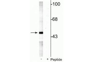 Western blot of rat testes lysate showing specific labeling of the ~49 kDa MEK5 protein phosphorylated at Ser311 Thr315 in the first lane (-). (MAP2K5 抗体  (pSer311, pThr315))