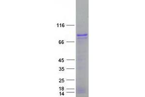 Western Blotting (WB) image for AlkB, Alkylation Repair Homolog 8 (ALKBH8) protein (Myc-DYKDDDDK Tag) (ABIN2714581)