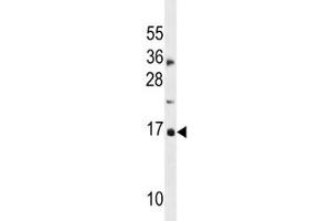 Western Blotting (WB) image for anti-Cyclin-Dependent Kinase Inhibitor 2A (Melanoma, P16, Inhibits CDK4) (CDKN2A) (AA 1-30) antibody (ABIN3030638)