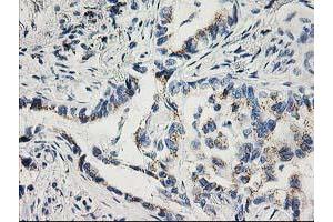 Image no. 5 for anti-Cyclin-Dependent Kinase 2 (CDK2) antibody (ABIN1497394) (CDK2 抗体)