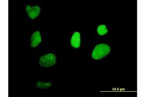 Immunofluorescence (IF) image for anti-X-Ray Repair Complementing Defective Repair in Chinese Hamster Cells 1 (XRCC1) (AA 1-633) antibody (ABIN521422)
