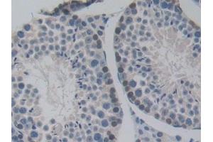 Detection of NUP85 in Mouse Testis Tissue using Polyclonal Antibody to Nucleoporin 85 (NUP85) (NUP85 抗体  (AA 418-653))