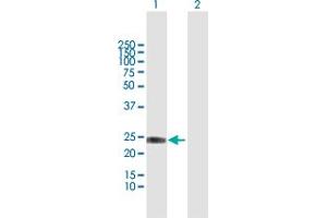 Western Blot analysis of IFNA8 expression in transfected 293T cell line by IFNA8 MaxPab polyclonal antibody. (IFNA8 抗体  (AA 1-189))