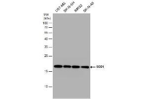 WB Image SOD1 antibody detects SOD1 protein by western blot analysis. (SOD1 抗体)